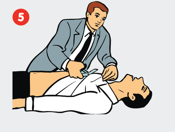 5-as žingsnis – paciento krūtinės paruošimas elektrodų uždėjimui