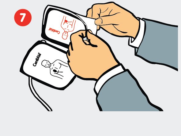 7-as žingsnis – defibriliatoriaus elektrodų pakuotės atplėšimas