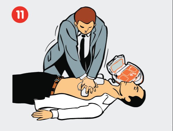 Gaivinimo veiksmai su CardiAid defibriliatoriumi – 11 žingsnis